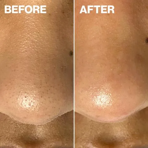 Dermapore  Blush